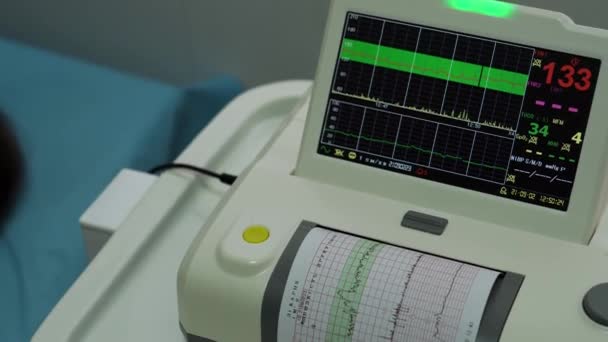 Elektroniczna Kardiotokografia Maszyna monitorująca skurcze serca płodu macicy. Drukowanie raportu kardiograficznego Wyjście elektrokardiogramu na oddziale pracy w czasie ciąży. Medyczny sprzęt diagnostyczny — Wideo stockowe
