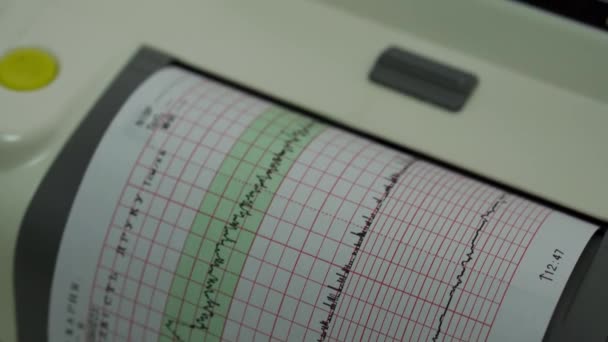 Elektronische Kardiotographie Maschine zur Überwachung fetaler Herzkontraktionen von Gebärmutterschleimhaut. Printing Cardiogram Report Coming Out Elektrokardiogramm In Wehen Station während der Schwangerschaft. Medizinische Diagnosegeräte — Stockvideo