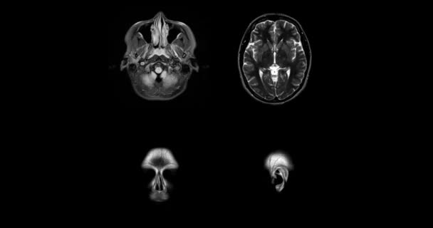 Mri Brain Different Projections Horizontal Vertical Lateral Top View Mri — Stock Video