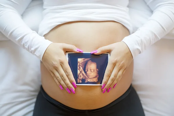 Pregnant woman holds ultrasound photo on the belly in bed — Stok fotoğraf