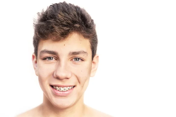 Hermoso Adolescente Sobre Fondo Blanco Con Aparatos Ortopédicos Los Dientes —  Fotos de Stock