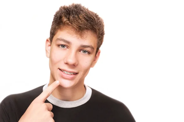 歯を指差すハンサムな男の子は 白い背景にブレースと笑顔で指を指しています — ストック写真