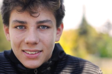 Genç yüzdeki sivilceden muzdarip. Dişlerinde tam mutluluk için diş telleri var. Cilt bakımı kavramı