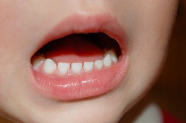 Küçük bir çocuk ağzını açtı ve alt, sağlıklı, beyaz dişlerini gösterdi. Kapat.