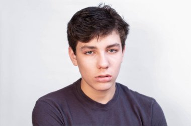 Genç çocuk tatilleri dört gözle beklediği için okulda çalışmaktan bıktığı için çok uykulu. Başı ağrıdığı için kendini kötü hissediyor. Yatay olarak