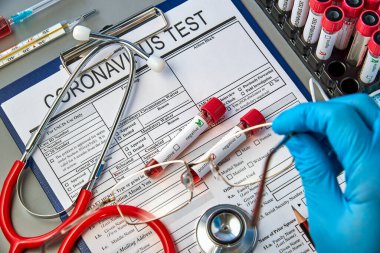 Coronavirus test formunda COVID-19 testi için kan örnekleri olan iki test tüpü. Yeni bir koronavirüs enfeksiyonunun nedensel maddesine karşı antikorların varlığı için kan testi.