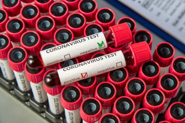 Vakumlu vakum tüplerinde COVID-19 için kan testi tüpleri. Yeni bir koronavirüs enfeksiyonunun nedensel maddesine karşı antikorların varlığı için kan testi.