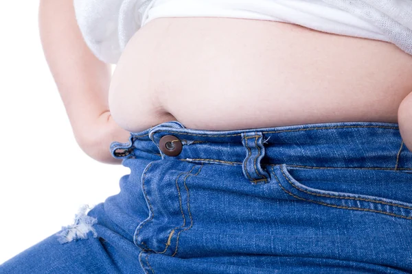 Obese patient — Stock Photo, Image