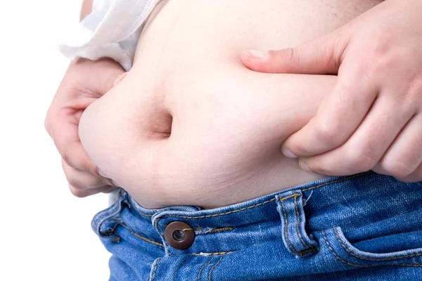 Obese patient — Stock Photo, Image