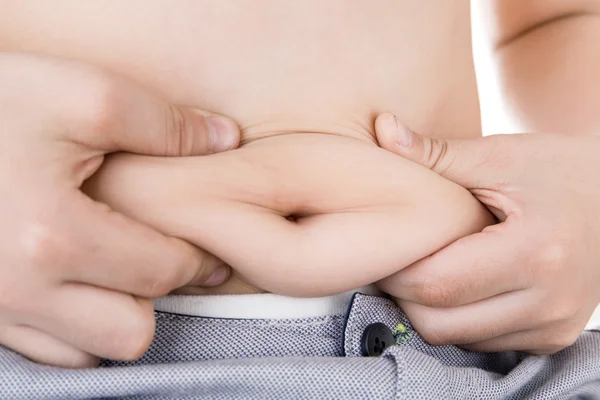Stomach of children with overweight. — Stock Photo, Image