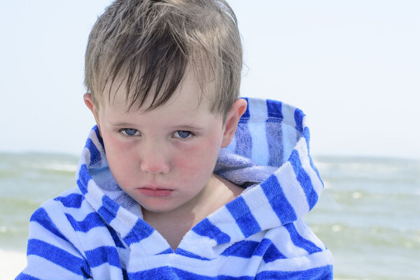 Little cute kid hurt and pouted, disappointed. Beautiful little kid with atopic dermatitis on the background of the sea