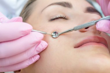 Yüzün derisini siyah noktalar ve sivilcelerden yapılmış kaşıkla temizleme işlemi..