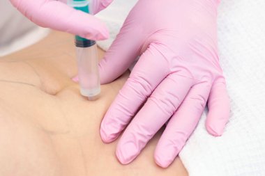 Lipolytic enjeksiyonlar mideye yerleştirilir. Pembe eldivenli kadın elleri karnına genç bir kadın enjekte ediyor..