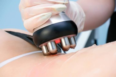 Doktor bacaklarda, kalçalarda ve sırtlarda Rf kaldırma prosedürü uyguluyor. Güzellik salonunda bir kadının kalçaları. Aşırı kilolu ve sarkık cilt tedavisi.