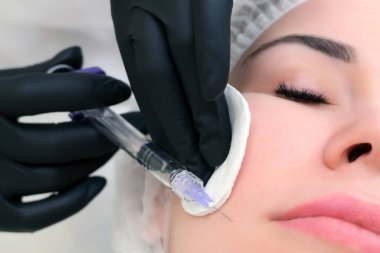 Deri yenilenmesi için kozmetik enjeksiyonlar. Kozmetik uzmanı genç bir kadının derisine şırınga enjekte ediyor..