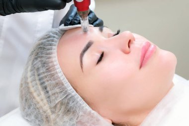 Needle mesotherapy. Cosmetologist performs needle mesotherapy on a womans face. Beautiful woman receiving microneedling rejuvenation treatment. Needle lifting clipart