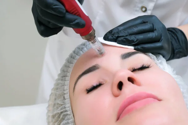 Needle mesotherapy. Cosmetologist performs needle mesotherapy on a womans face. Beautiful woman receiving microneedling rejuvenation treatment. Needle lifting