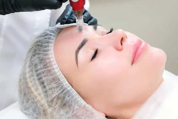 Ğne Mezoterapisi Kozmetik Uzmanı Bir Kadının Yüzünde Iğne Mezoterapisi Yapıyor — Stok fotoğraf