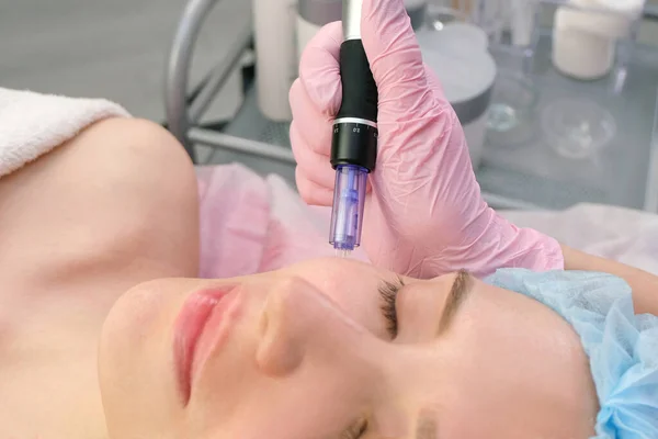 Needle mesotherapy. Cosmetologist performs needle mesotherapy on a womans face. Beautiful woman receiving microneedling rejuvenation treatment. Needle lifting