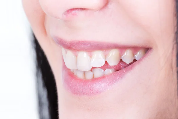 Женщина улыбается белыми зубами — стоковое фото