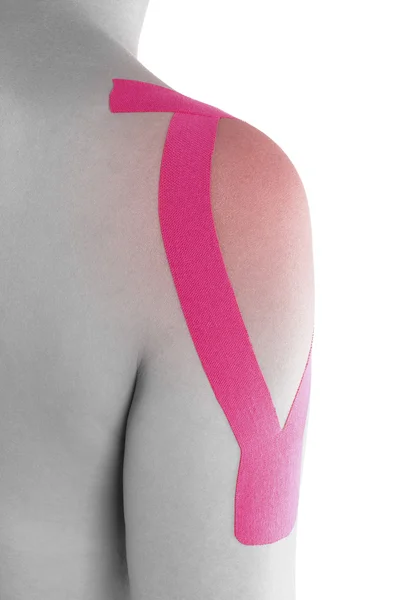 Kinesio fita no ombro feminino — Fotografia de Stock