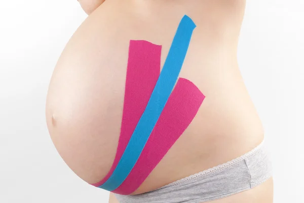 Kinesio tape op zwangere. — Stockfoto