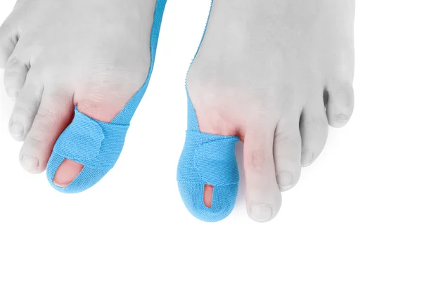 Therapeutic tape on female toe. — Stock Photo, Image