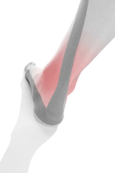 Therapeutic tape on female heel. — Stock Photo, Image