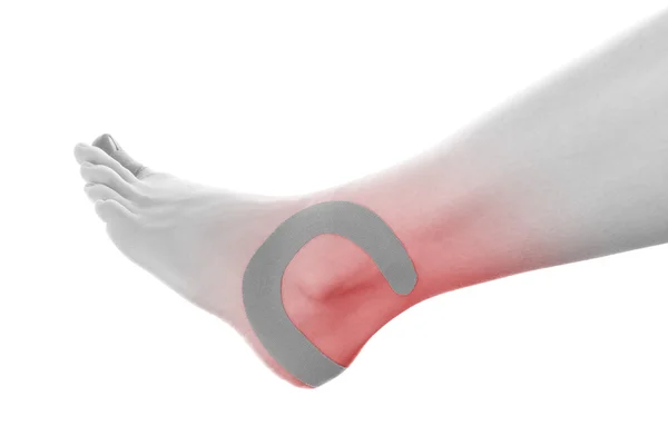 Therapeutic tape on female ankle. — Stock Photo, Image