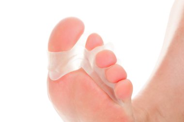 Nasır, hallux valgus. Beyaz arka planda izole ayaklarda silikon parmak ayırıcı.