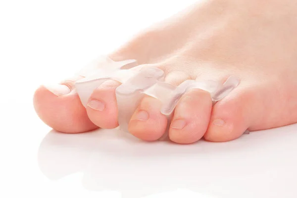 Αρσενικά Γυμνά Πόδια Bunion Correctors Για Θεραπεία Του Πόνου Στο — Φωτογραφία Αρχείου