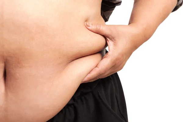 Λίπος γυναίκα απομονωμένη podgy παχύσαρκος ολοστρόγγυλος Βαρελοειδής παχουλό — Φωτογραφία Αρχείου