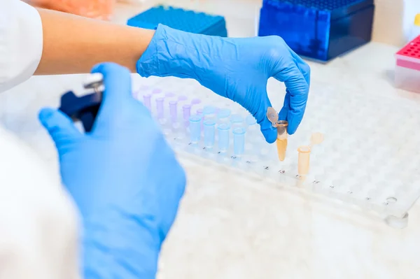 Handen wetenschapper chemicus (bioloog, arts) met een reageerbuis en plaat in moderne laboratorium — Stockfoto