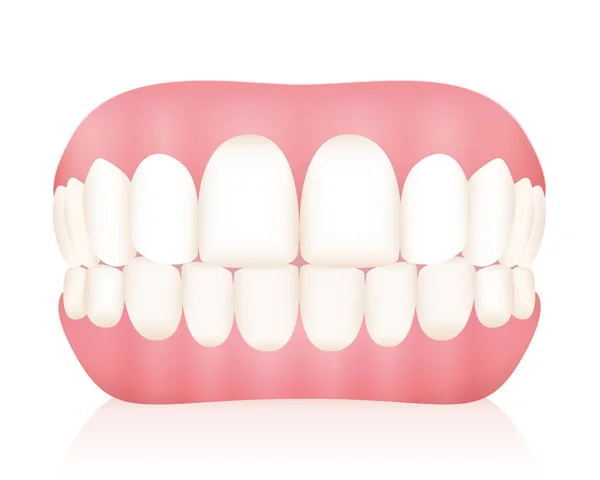 Dentures False Teeth Isolated Vector Illustration White Background — Stock Vector