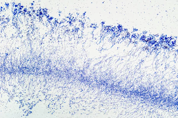 현미경으로 Penicillium 균사체 Mycelium 균류의 식물성 가지같은 실감개 덩어리입니다 항생제 — 스톡 사진