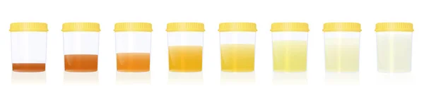 Urine Colors Gradations Clear Yellow Orange Even Darker Samples Specimen — Stock Vector