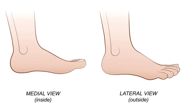 Pé Lateral Medial View Inside Outside Profile —  Vetores de Stock