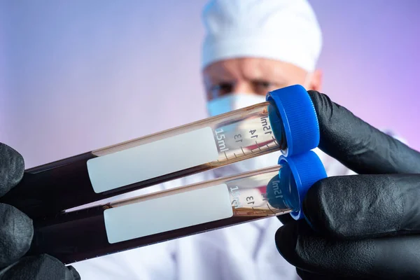 Blood test. The doctor is holding test tubes of blood with clean labels. Laboratory diagnostics. Lab technician hands with blood samples in test tubes. Lab technician holds blood samples for testing.