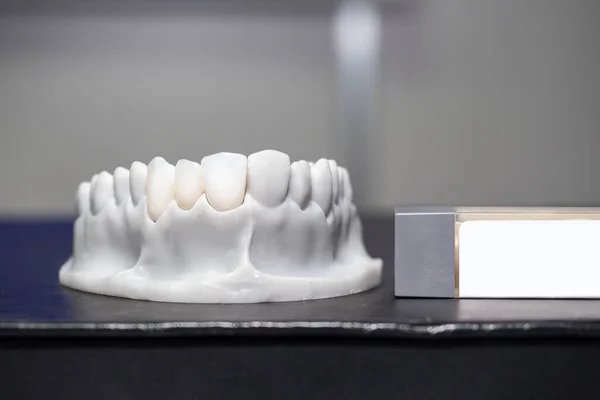 Plaster denture close-up. White denture on the table. The lower part of the jaw is made of plaster. Orthodontist\'s visual aid. Denture for dentist training. Dentures to dental education