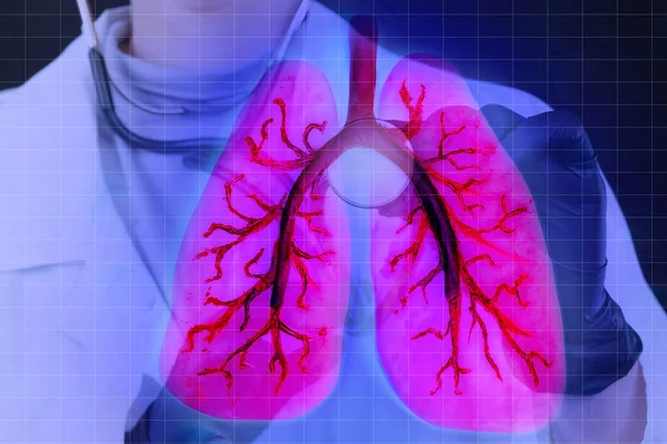 Lungs on doctor virtual screen. Lungs human in anatomy. Doctor performs an analysis of human lungs. Human organism. Affected organism is displayed on screen. Signs of the disease.Pneumomania