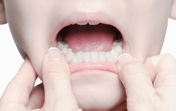 Tandartsen Handen Open Meisjes Mond Conditie Van Tanden Controleren Tijdens — Stockfoto