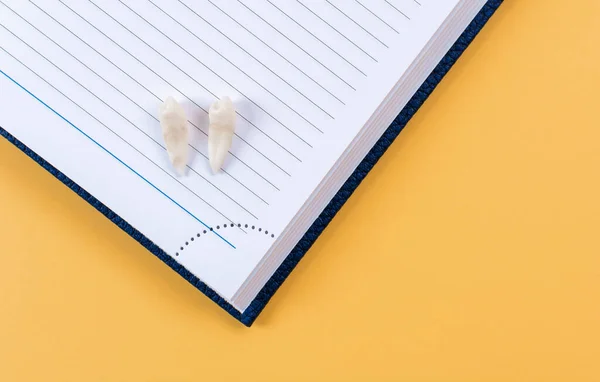 Extracted baby teeth on the pages of an open notebook. The concept of writing to the dentist