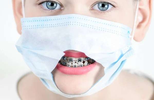 Mooi Meisje Met Medisch Masker Glimlachend Met Tandbeugels Begrip Tandheelkunde — Stockfoto
