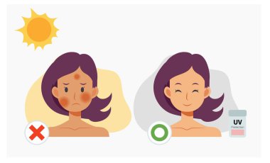 Güneş koruması olan bir kadın. Ultraviyole koruma kullanmadan önce ve sonra. Düz Vektör İllüstrasyonu