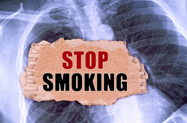 Medicine Concept Ray Piece Cardboard Inscription Stop Smoking — Foto de Stock