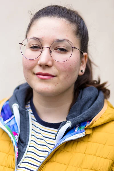 Jolie Fille Avec Des Lunettes Des Problèmes Peau Visage Photo — Photo