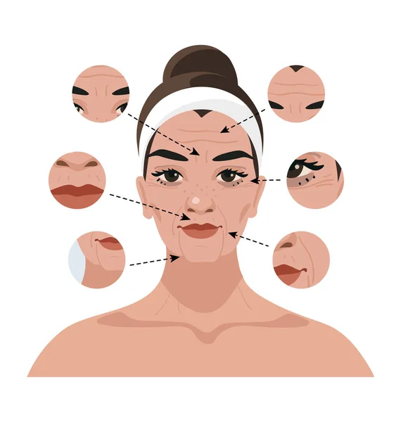 Portret van een vrouw met leeftijdsgebonden veranderingen op het gezicht en rimpels. Illustratie voor een schoonheidssalon, cosmetische ingrepen, injecties, plastische chirurgie. Platte vectorillustratie. — Stockvector