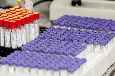 farklı bir laboratuvar tüplerde