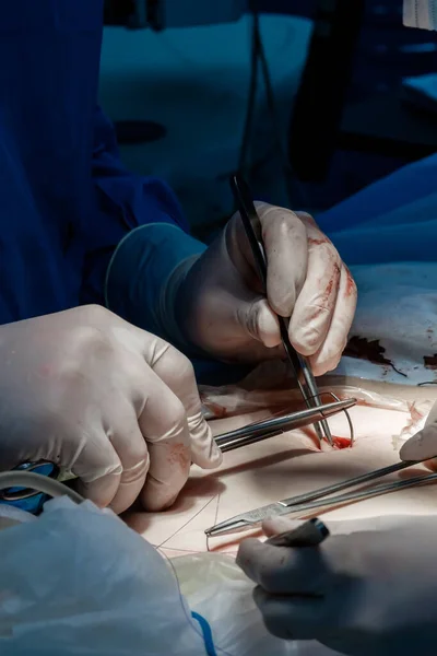 Doctors use medical instruments and metal thread to suture human skin.