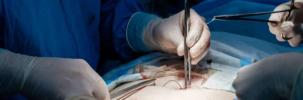 Doctors use medical instruments and metal thread to suture human skin.